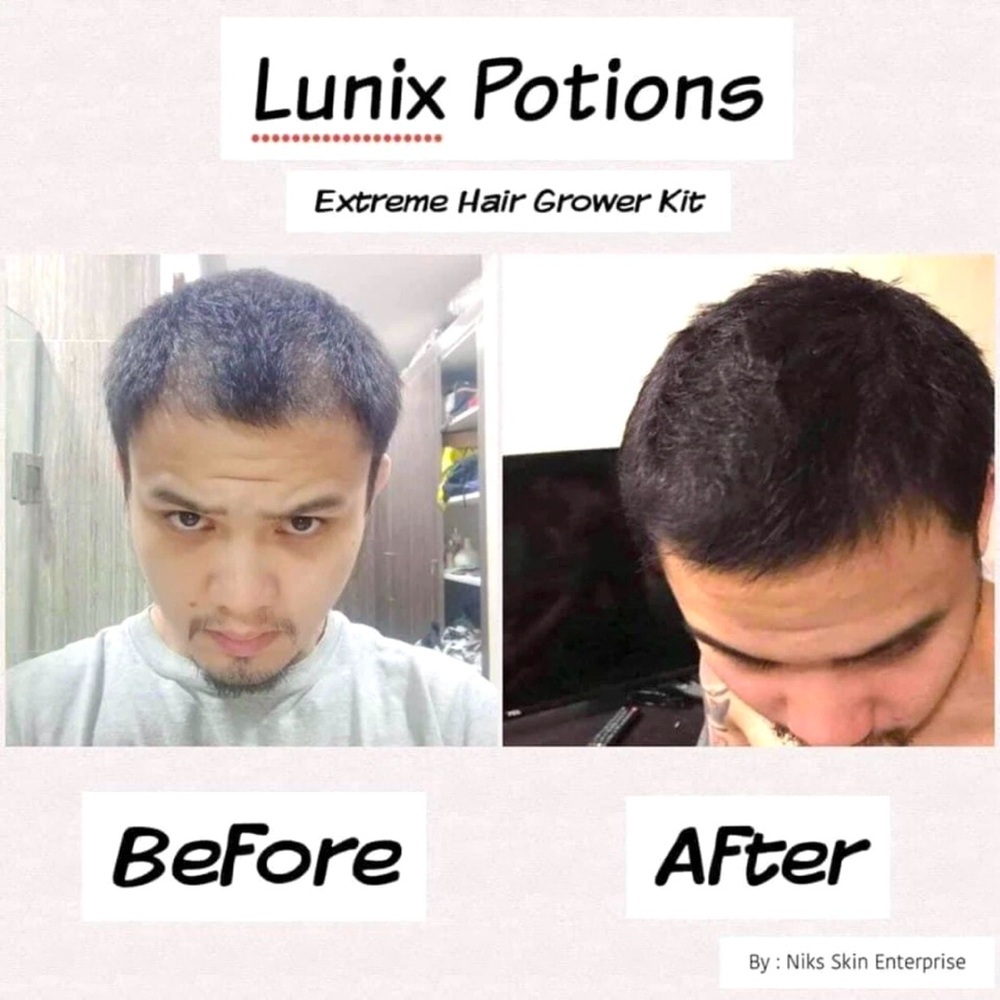 Hair Growth Treatment - Picture 9 of 10